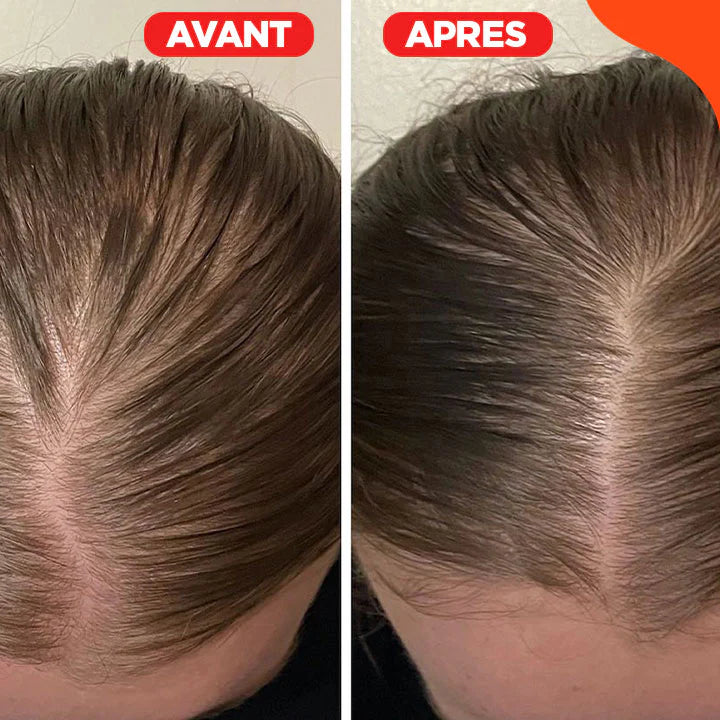 HairBeam