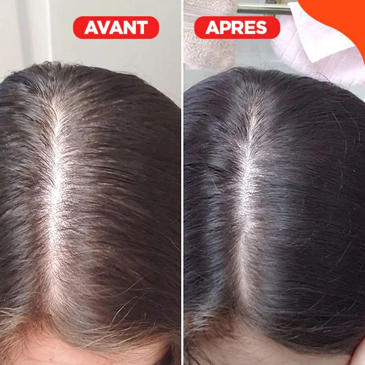HairBeam